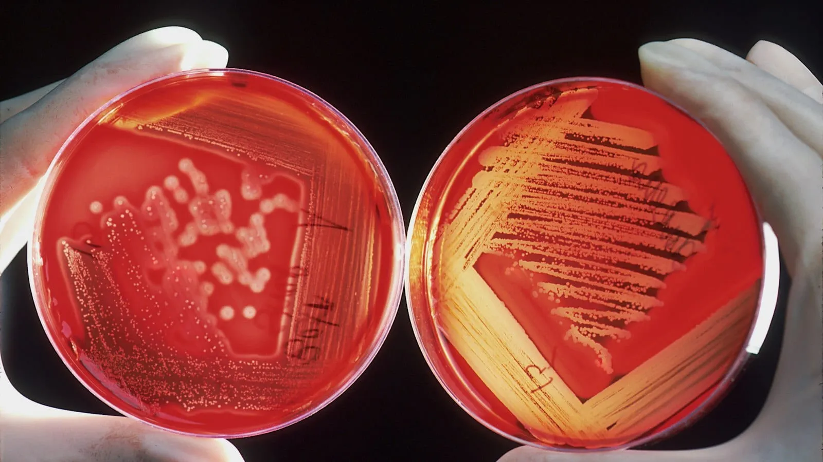 Gloved hands holding two petri dishes with bacterial cultures (stock photo)